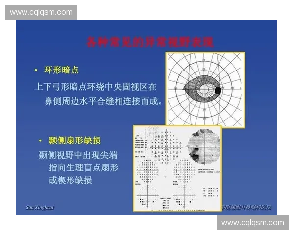 深入解析压耳技巧在日常训练与放松实践中的全面应用与优化策略